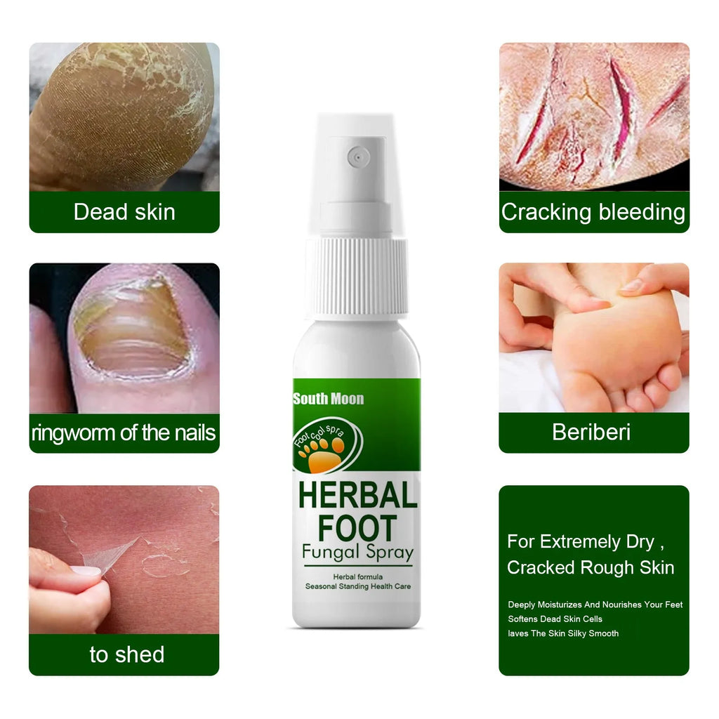 30ml foot skin nourishing and hydrating care spray in spray bottle