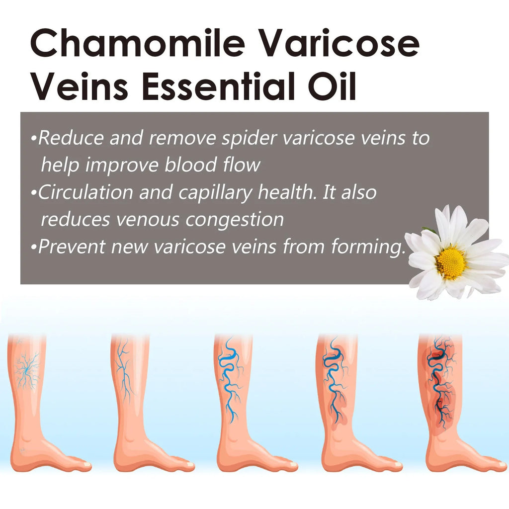 10ml bottle of chamomile essential oil for leg massage and skin care.