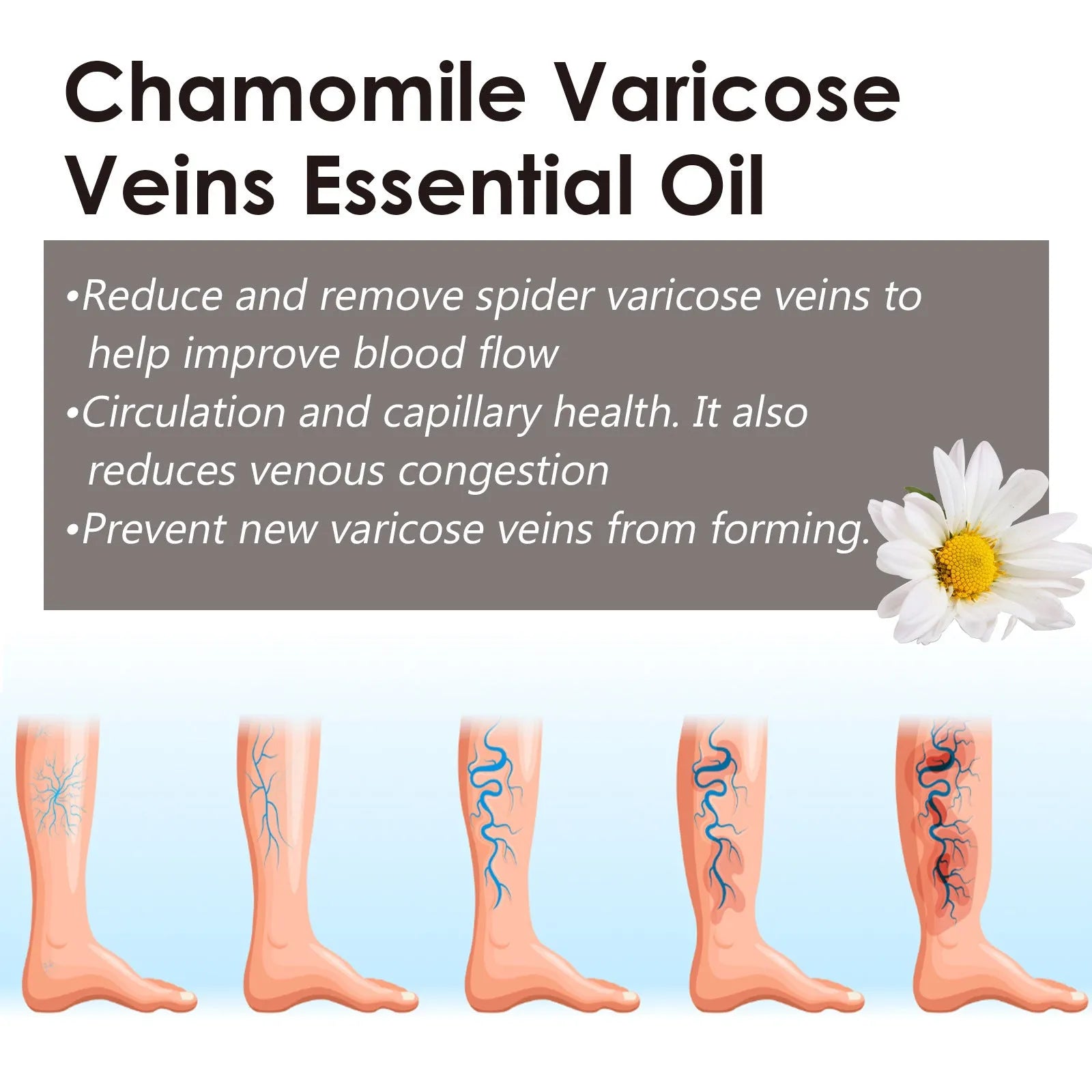10ml bottle of chamomile essential oil for leg massage and skin care.