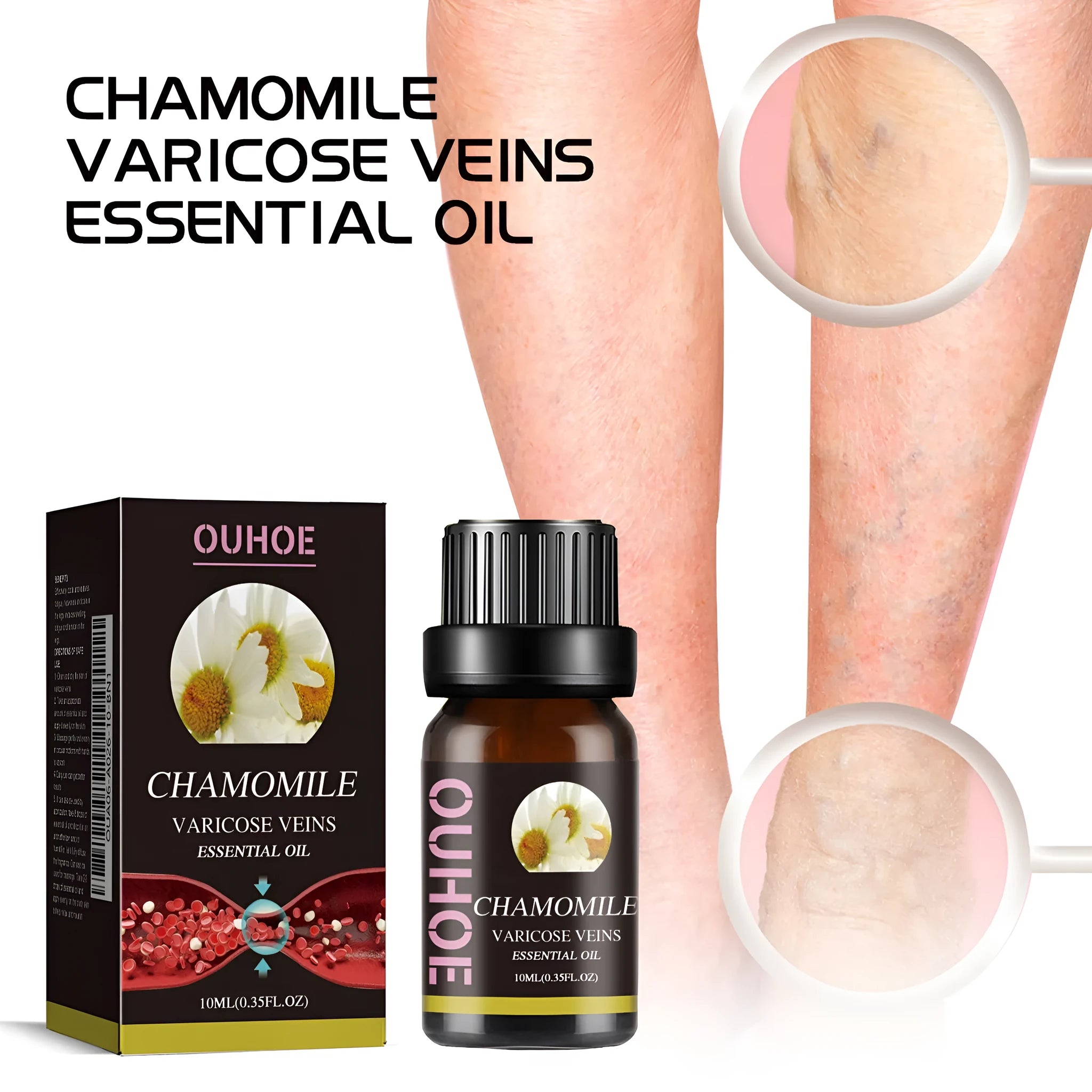 10ml bottle of chamomile essential oil for leg massage and skin care.