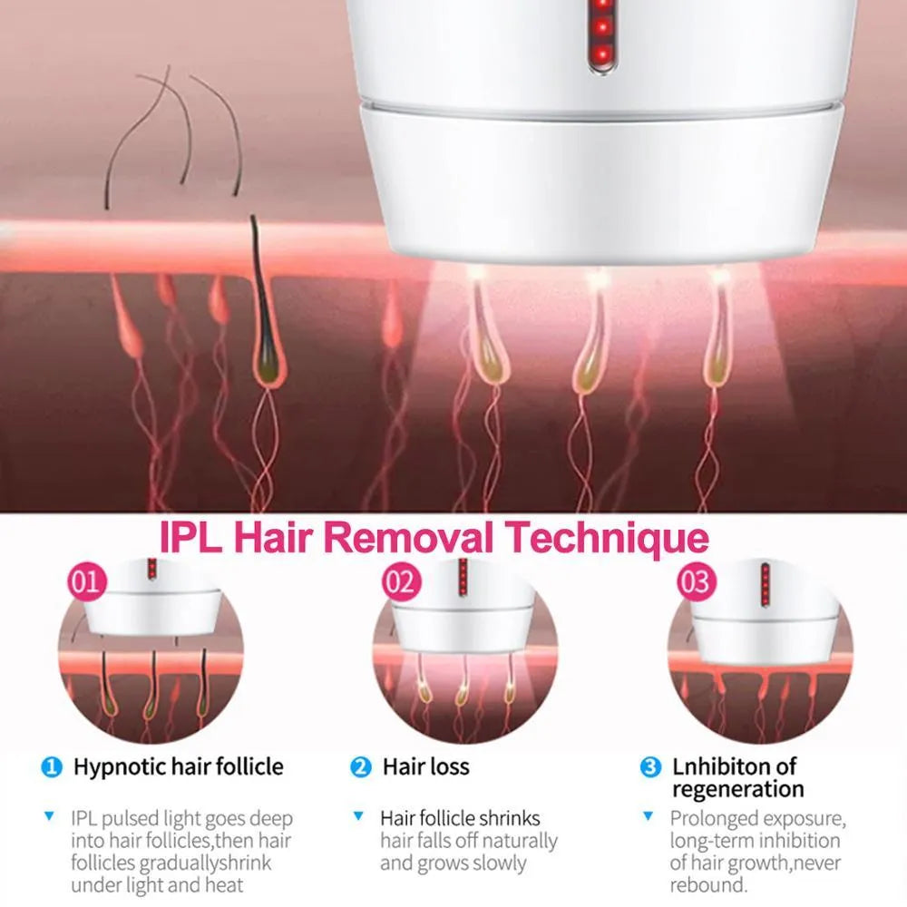 White home laser hair removal instrument with display screen and adapter plugs for UK, EU, US, and AU sockets.