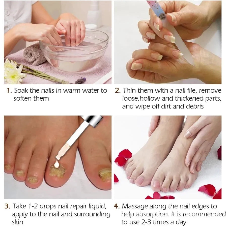 Jiagou Repair Dust antimicrobial footcare liquid in 10ml bottle