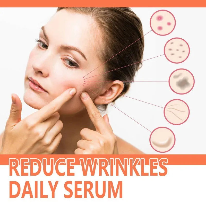 30ml rose essential oil serum in 3.8x3.8x8.6cm bottle for fine wrinkle smoothing