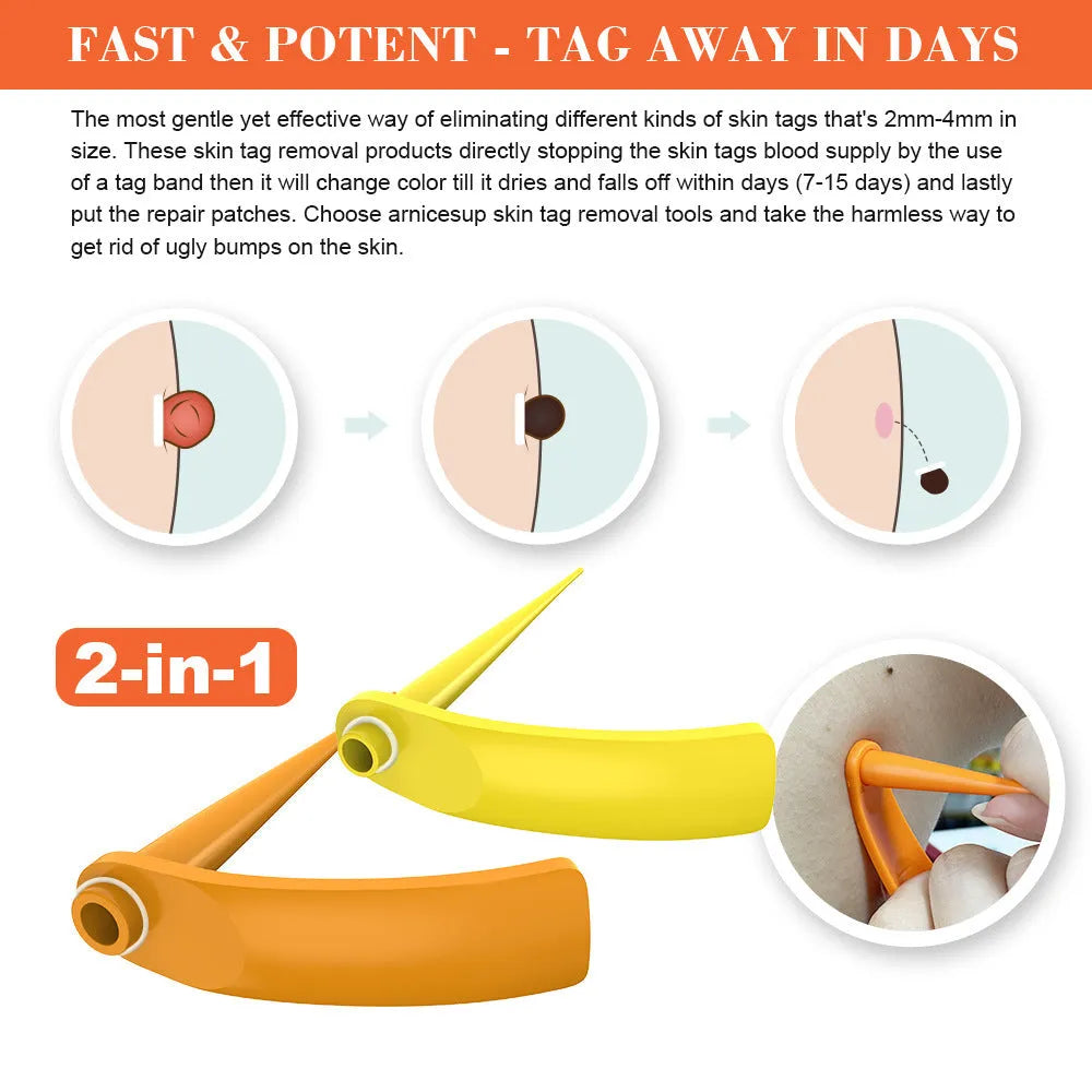 Orange yellow wart removal tool kit with devices, rubber rings, alcohol swabs, and accessories