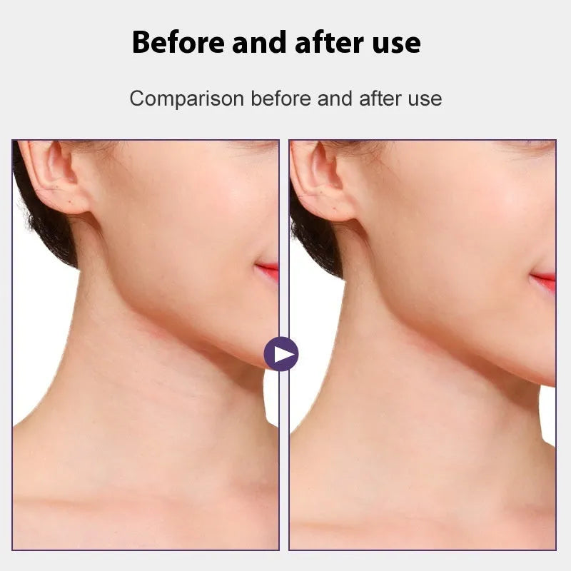 Skin tone neck firming adhesive tape with 4 pieces and 20 patches package