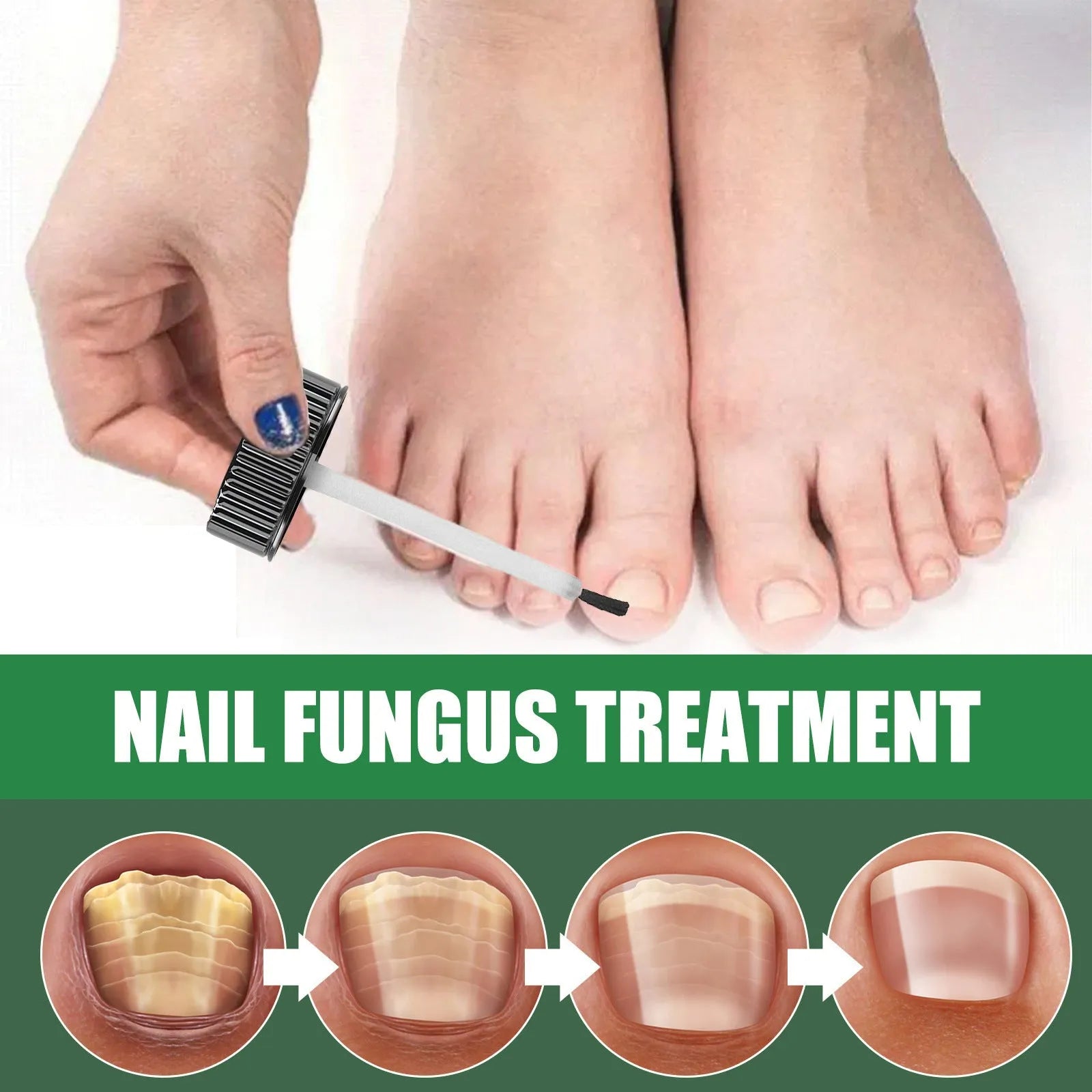 30ml tea tree oil nail repair solution bottle for hand and foot nail care treatment