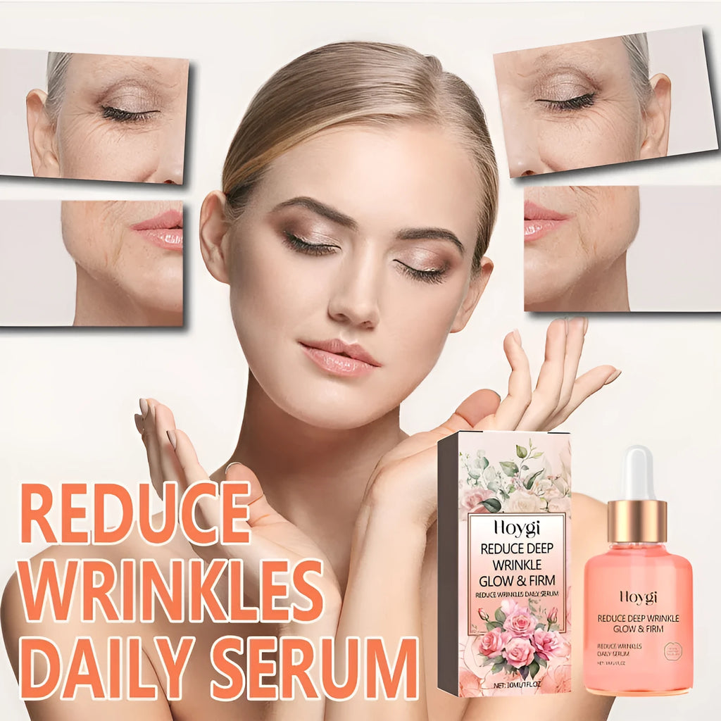 30ml rose essential oil serum in 3.8x3.8x8.6cm bottle for fine wrinkle smoothing