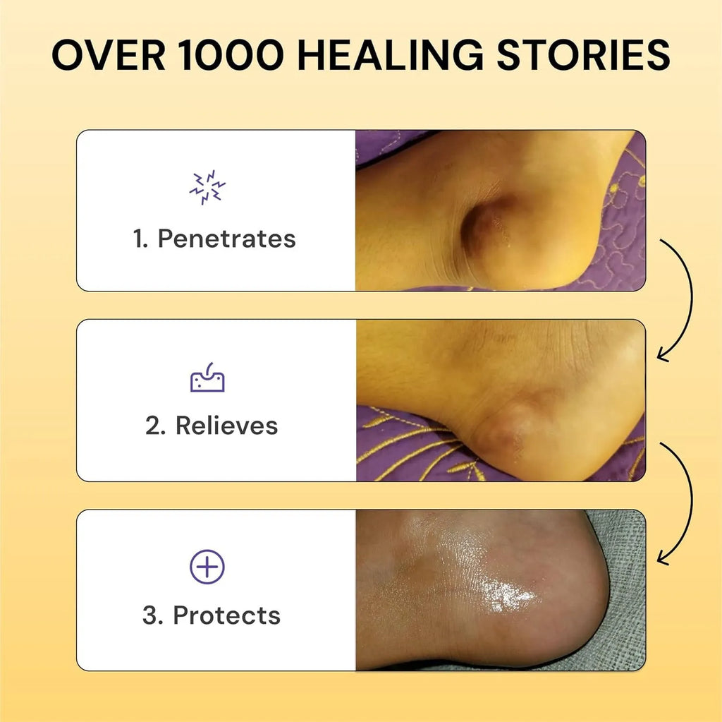 120g tube of Flare Care muscle and joint pain relief cream with no logo branding